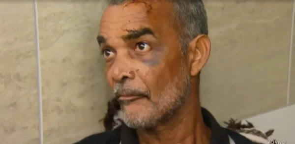 Homem machucado dando entrevista