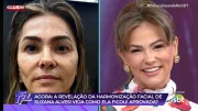 Antes e depois da harmonização da Tiazinha 
