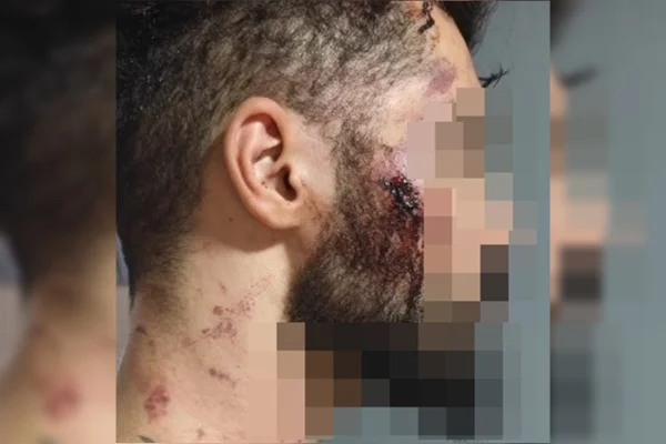 Motorista de app é espancado no DF após briga de trânsito - destaque galeria Motorista de app é espancado no DF após briga de trânsito - destaque galeria