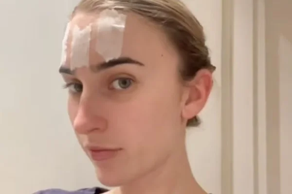 Face taping