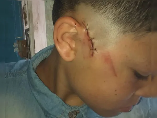 Segurança entra em briga, tenta bater em grávida e acerta paulada em criança de 9 anos