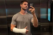 Ex-BBB Jonas Sulzbach relata dificuldades por conta de gesso no braço Ex-BBB Jonas Sulzbach relata dificuldades por conta de gesso no braço