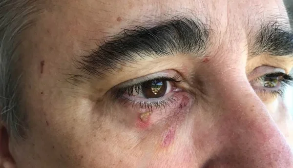 Ao Supremo, ministro Admar Gonzaga diz que apanhou da mulher