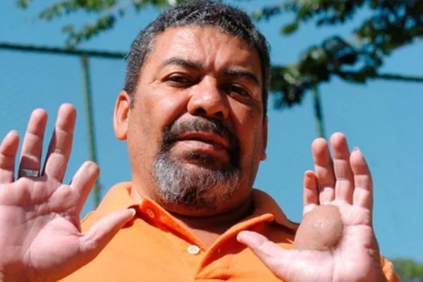 Odesson Alves Ferreira -Metrópoles
