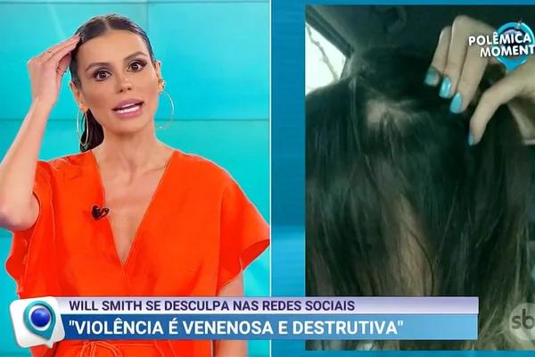 Gaby Cabrini revela que teve alopecia