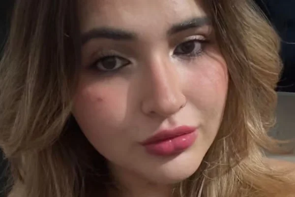 Imagem colorida, Estudante de biomedicina morre após galho cair sobre sua cabeça no MS - Metrópoles