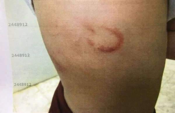 Mulher é presa por torturar e agredir filha de 5 anos com corrente