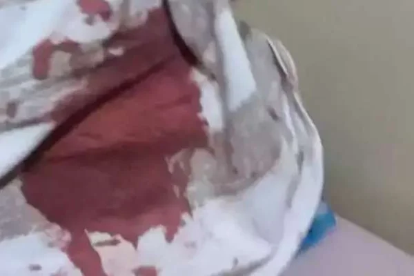 Imagem colorida, jovem sujo de sangue após ser esfaqueado pelo padrastro - Metrópoles