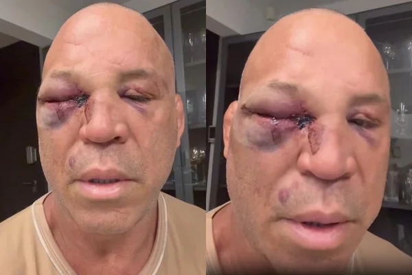 Montagem colorida com fotos de Wanderlei Silva - Metrópoles