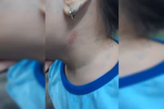 Mãe denuncia professora de escola pública por agredir filha de 4 anos
