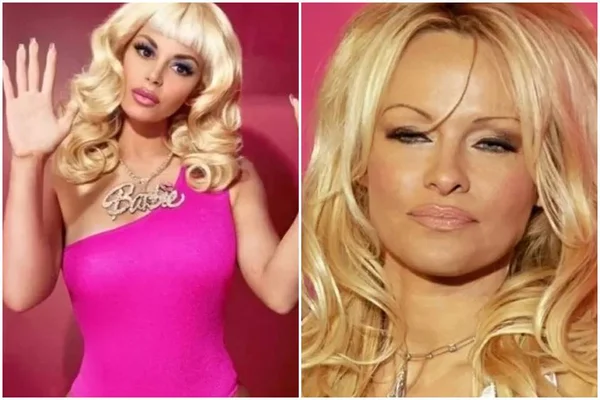 Barbie humana gasta R$ 75 mil para ter “seios de Pamela Anderson”