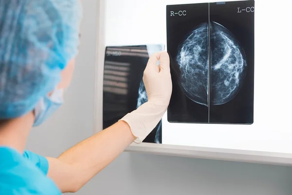 Mamografia 3D revoluciona diagnóstico de doenças com imagens precisas
