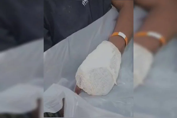 Homem tem mão atingida ao tentar evitar disparo após briga com rival