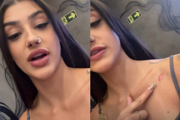 Bia Miranda mostra ferimento após acidente