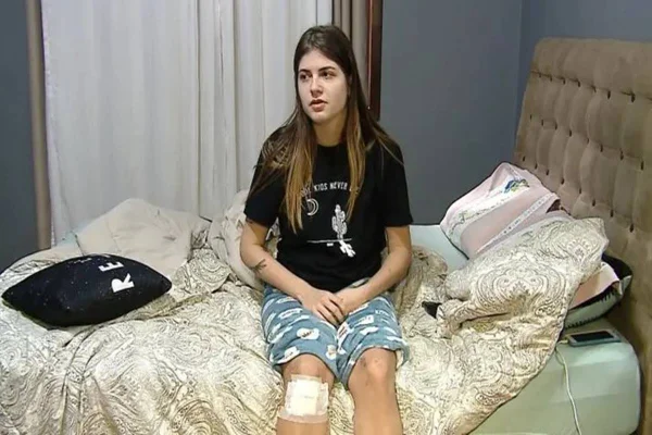 Foto colorida de uma mulher com ferimentos na perna- Metrópoles