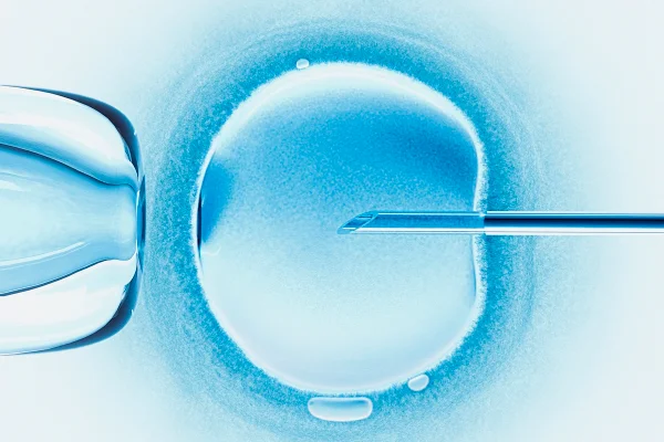 Imagem mostra uma agulha entrando em um óvulo, inseminação artificial - Metrópoles