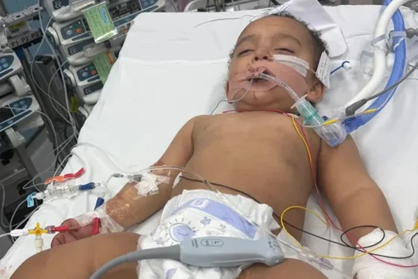 Foto colorida de um bebê, em ambiente hospitalar, com tubos de respiração - Metrópoles