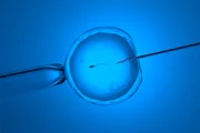 A fertilização in vitro (FIV) é a técnica mais popular de reprodução assistida A fertilização in vitro (FIV) é a técnica mais popular de reprodução assistida