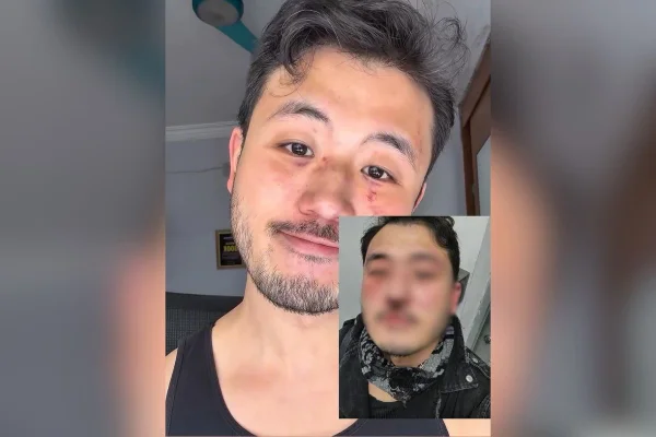 Imagem colorida mostra professor que denunciou agressão por homofobia no metrô. Metrópoles