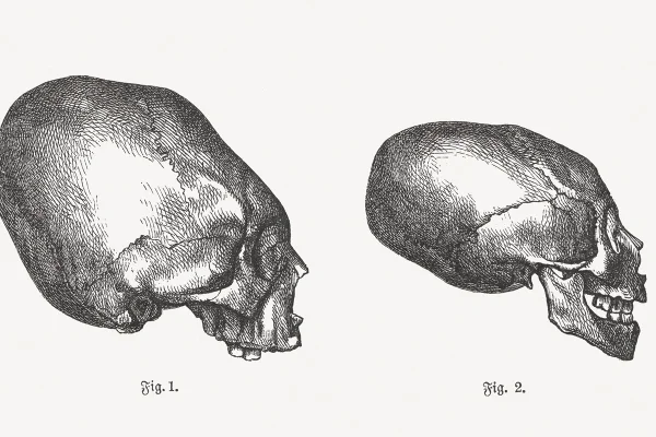 Ilustração em preto e branco mostra deformação craniana intencional - Metrópoles