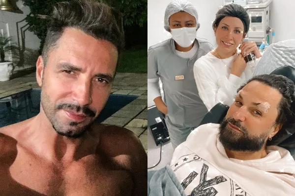 Latino passa por procedimento estético com Dra. Caroline Pereira (Reprodução)