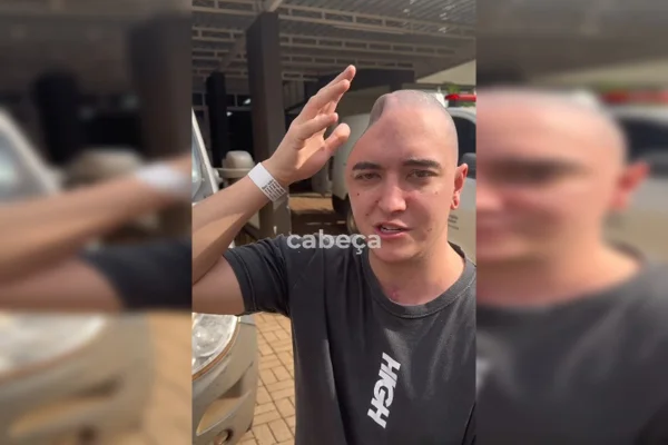 Jovem sem parte do osso da cabeça