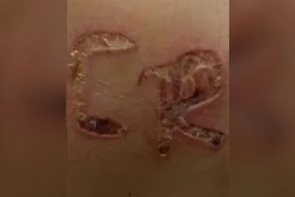 Imagem colorida de iniciais de sobrenome de esposo nas costas de mulher