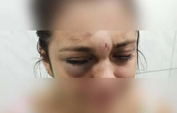 Nas redes, mulher diz ser espancada pelo namorado: “Me chamou de vagabunda”
