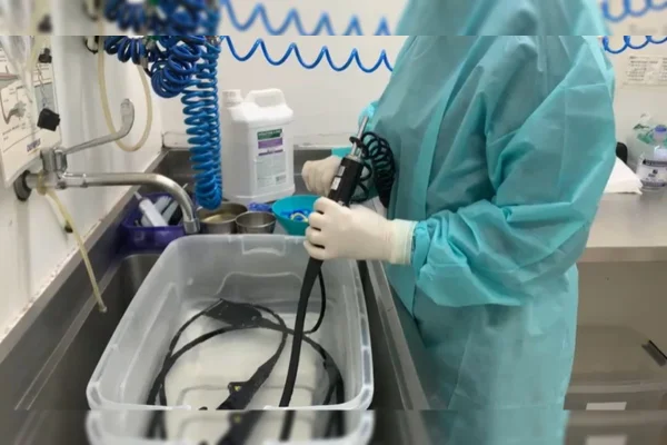 TCDF detecta 21,5 mil pacientes à espera de endoscopia na rede pública
