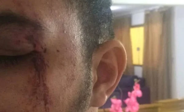 Polícia investiga denúncia de agressão e roubo no bar Outro Calaf