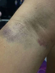 Vítima ficou com vários hematomas pelo corpo