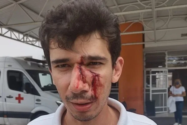 Gerente de mercado pede que cliente coloque máscara e recebe golpe de skate