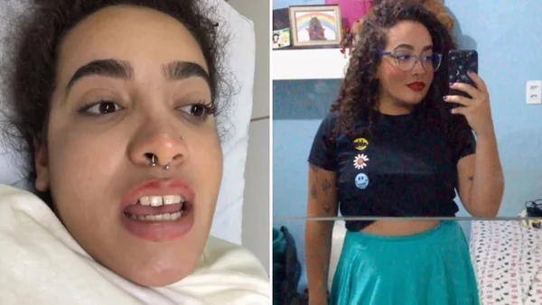 goias jovem reclama apos queda de rampa