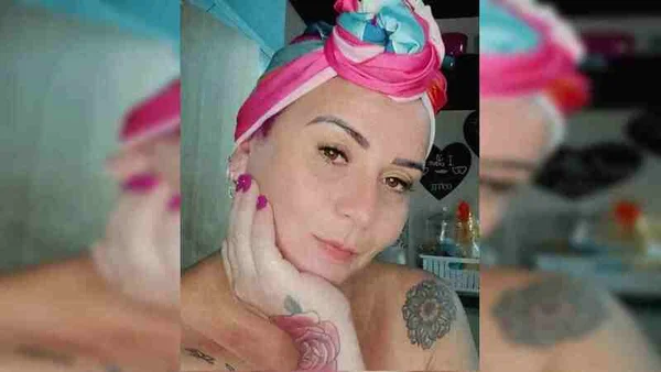 Professora teve câncer no globo ocular