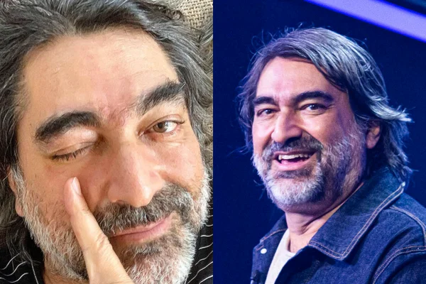 Zeca Camargo se recupera de cirurgia no olho