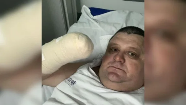 Humorista de Santa Catarina perde a mão após acidente com fogos