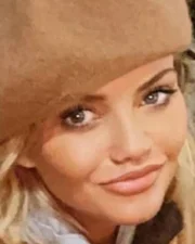 Atriz que teve rosto corroído por cocaína aparece irreconhecível. Veja - imagem 2 Atriz que teve rosto corroído por cocaína aparece irreconhecível. Veja - imagem 2