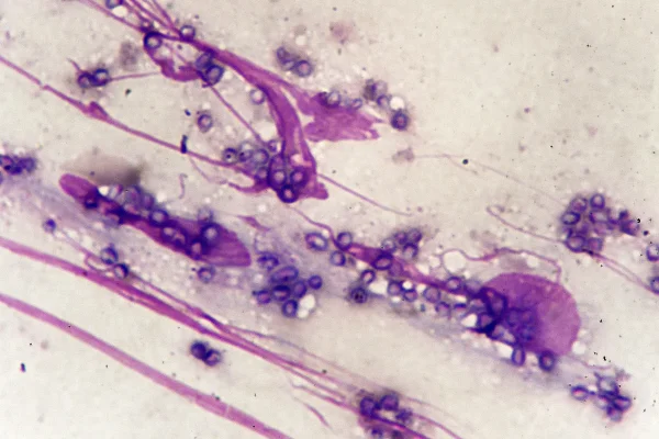Imagem de microscópio mostra o fungo Talaromyces marneffei na pele humana - Metrópoles