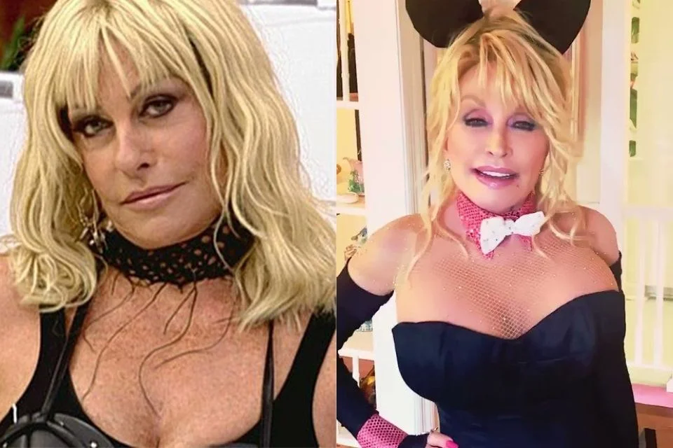 Ana Maria Braga foi comparada à atriz Dolly Parton Ana Maria Braga foi comparada à atriz Dolly Parton