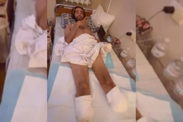 Brasileiro na Ucrânia teve parte das pernas e do braço amputados