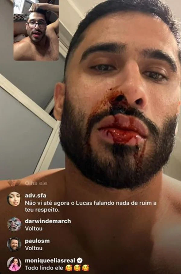Ex-affair acusa Lucas Souza de agressão: “Fiz uma denúncia” - destaque galeria Ex-affair acusa Lucas Souza de agressão: “Fiz uma denúncia” - destaque galeria
