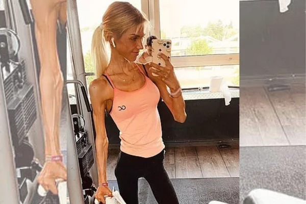 modelo morre de anorexia