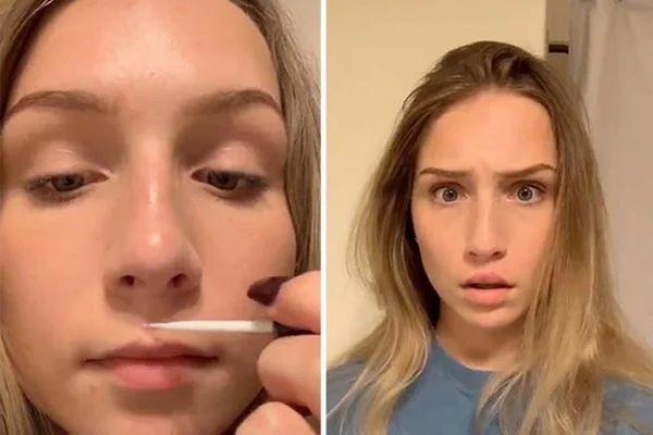 Atenção, pais! Jovens usam supercola para lábios ficarem maiores
