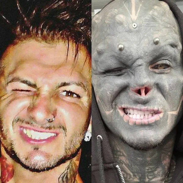 Anthony Loffredo, que está se transformando em um alienígena