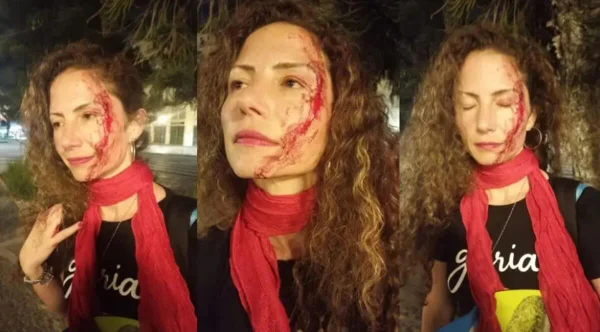 Jornalista da CNN espancada