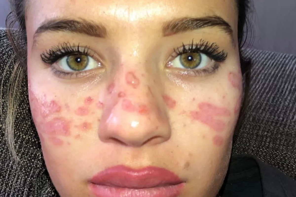 A australiana tentou fazer o truque de beleza viral depois de ver um vídeo sobre o assunto no TikTok A australiana tentou fazer o truque de beleza viral depois de ver um vídeo sobre o assunto no TikTok