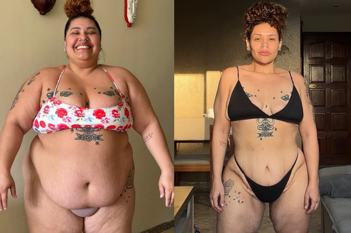 Antes e depois de Aila Menezes Antes e depois de Aila Menezes