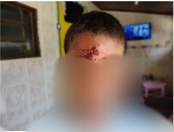 Mãe apedreja filho de 7 anos na testa e acaba presa no DF