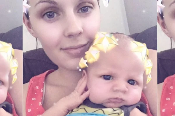 Durante cesariana, mãe puxa bebê do próprio útero