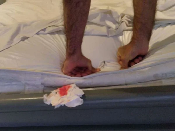 HOMEM MOSTRA PREGO DENTRO DA CAMA DE MOTEL ONDE FUROU O JOELHO - METRÓPOLES